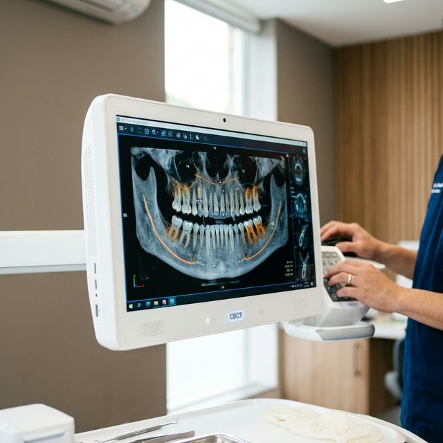 3D КТ-диагностика