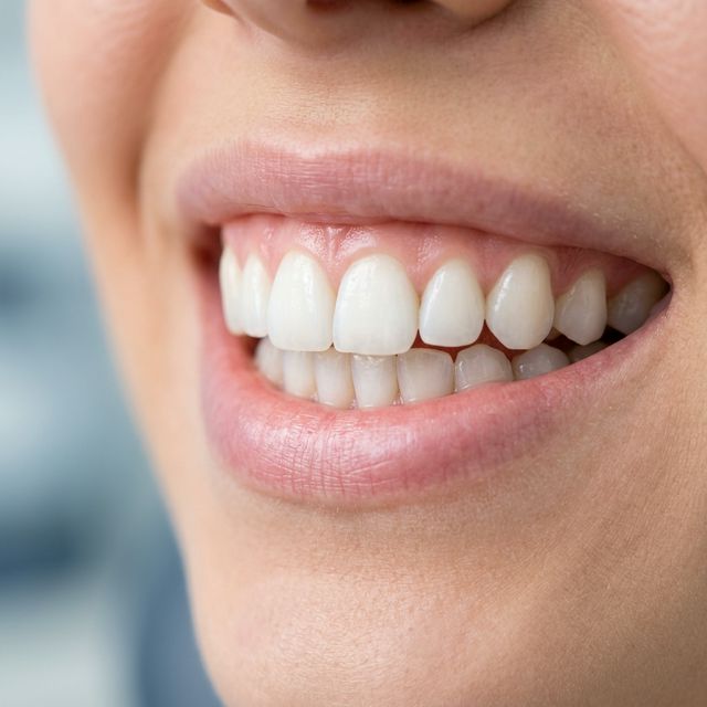 Эстетическое совершенство улыбки